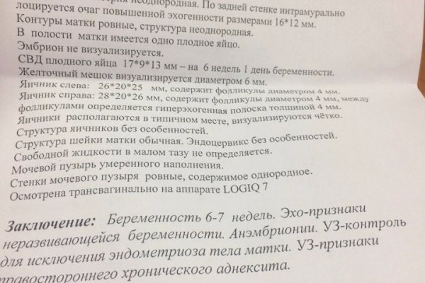 Кракен сайт kr2web in цены