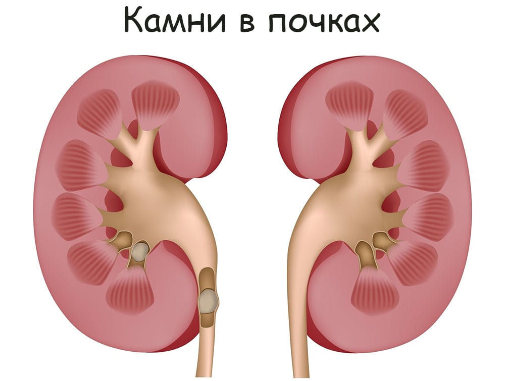 Купить наркотики в москве
